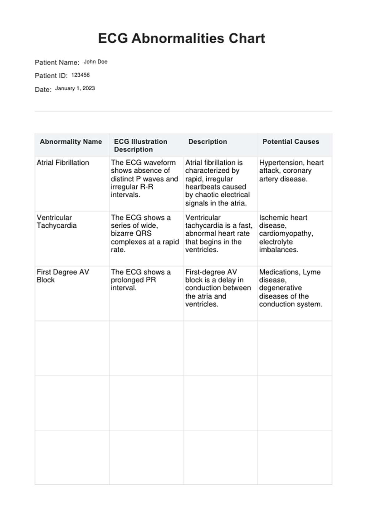 ECG Abnormalities Chart Example Free PDF Download
