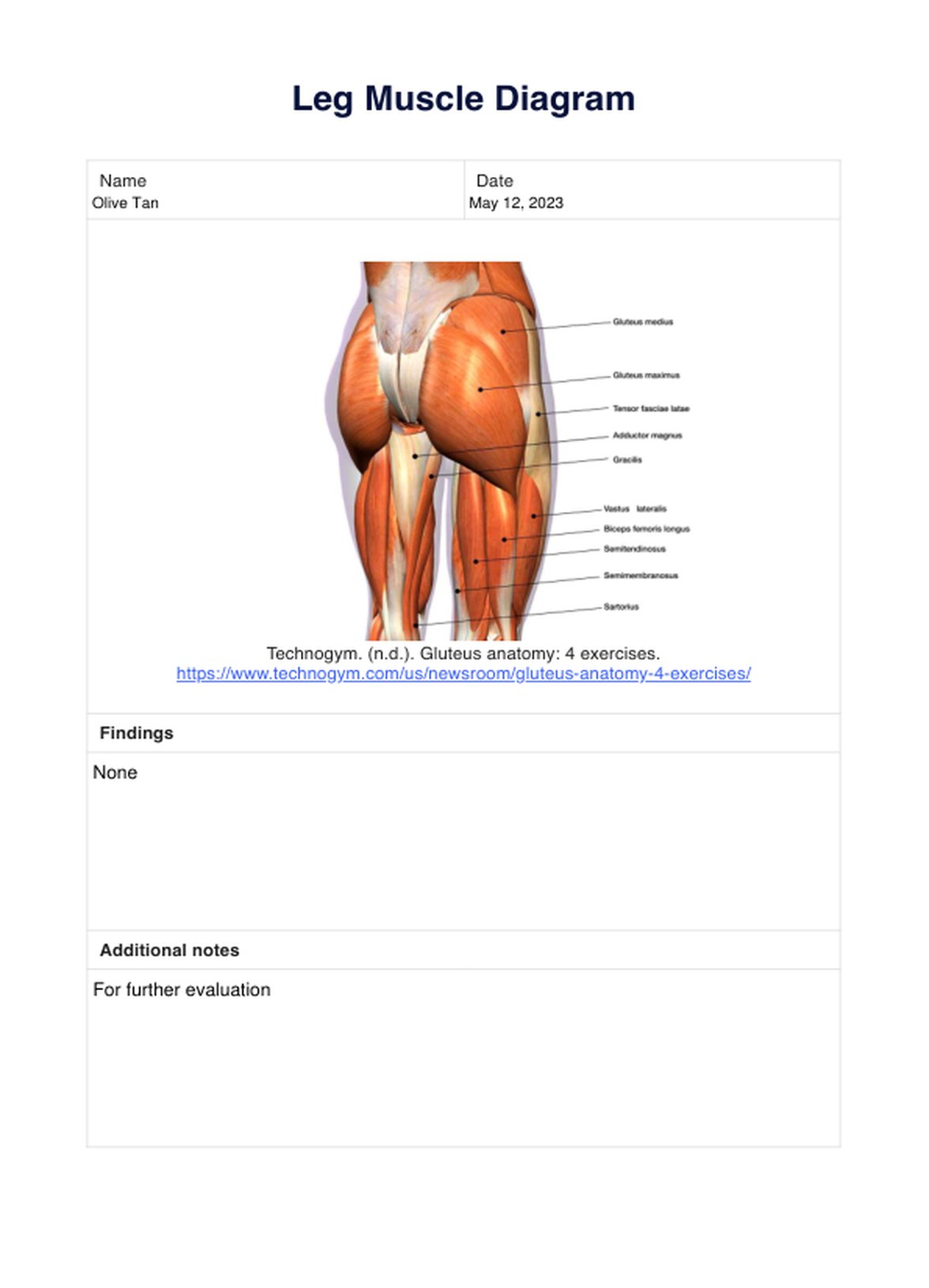 Glute Muscle Diagram & Example Free PDF Download