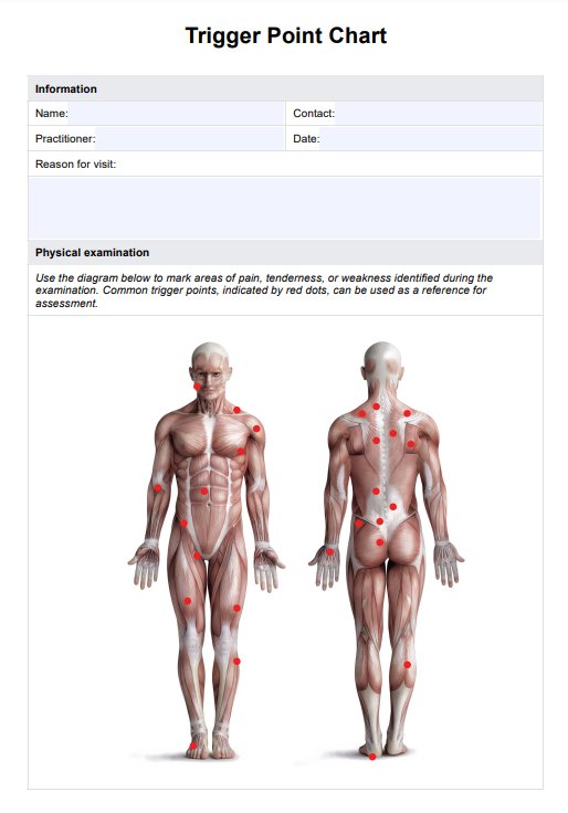 Body Trigger Points Chart 1500x1500 Body Trigger Points Chart 1500x1500