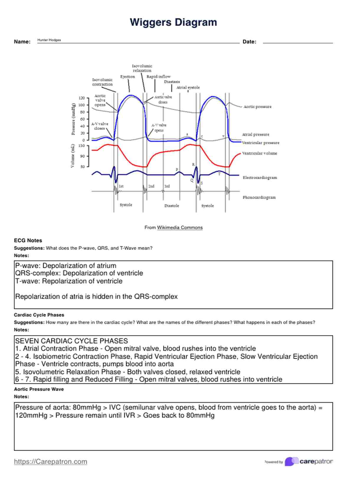 Wiggers Diagram & Example | Free PDF Download